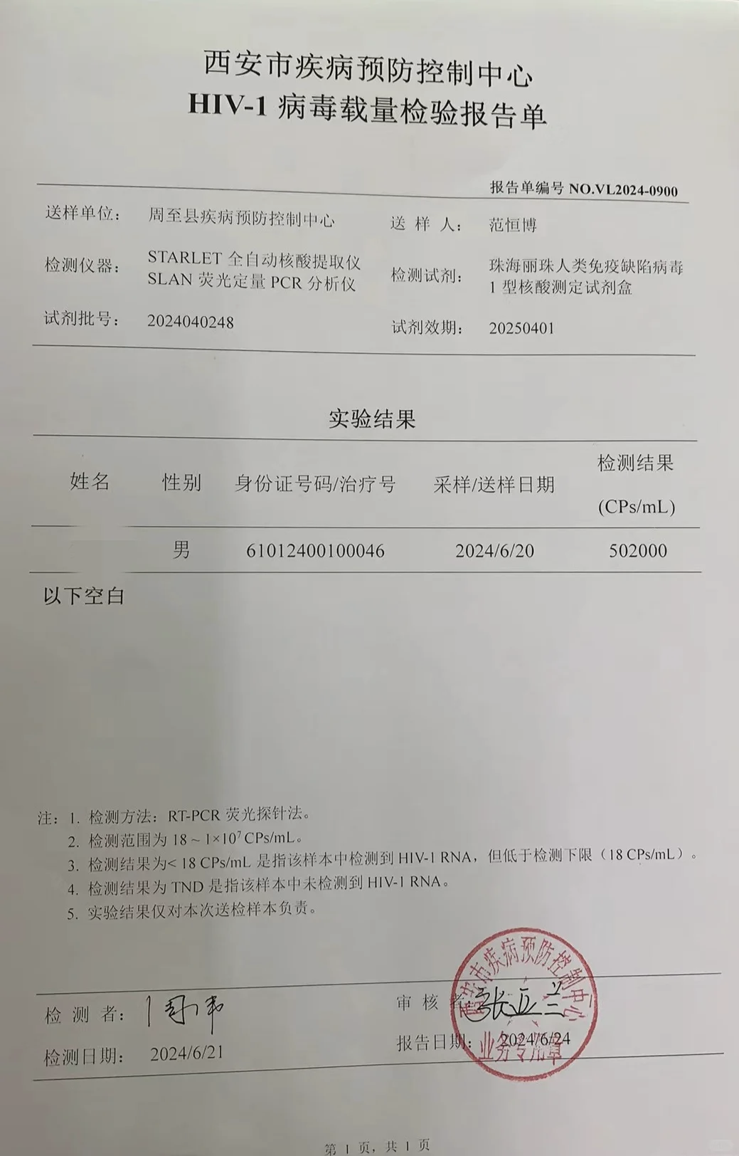 艾滋病第四代检测多久可以出结果(第四代艾滋病联合检测30天准确吗)