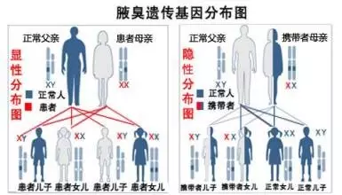狐臭会不会遗传给下一代(遗传性狐臭怎么不遗传给下一代)