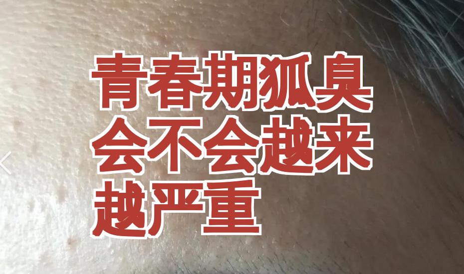 狐臭会不会变严重(狐臭会不会遗传给下一代)