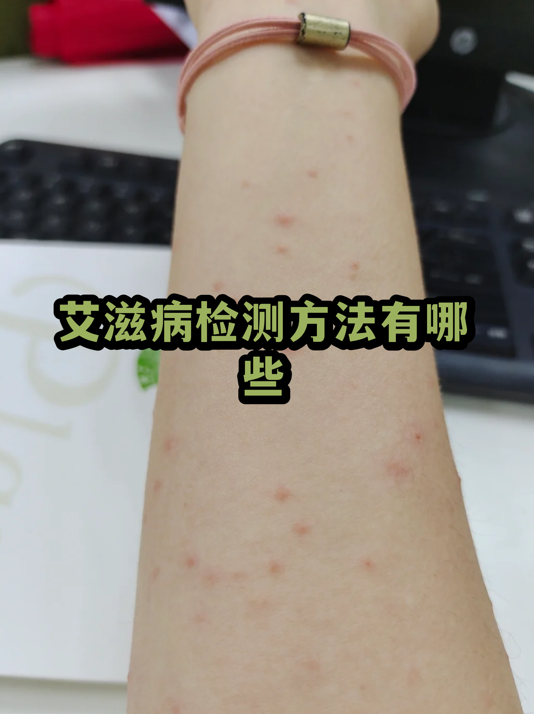 艾滋病第四代检测方法多久排除(艾滋病第四代检测方法多久排除?)