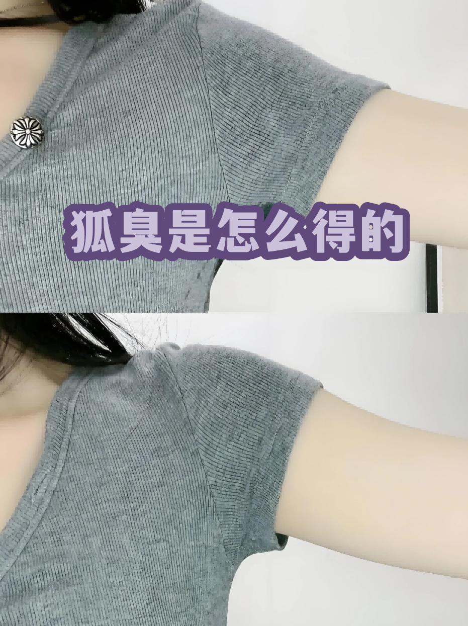 怎么判断是狐臭还是腋臭(怎么判断是狐臭还是腋臭呢) 怎么判断是狐臭还是腋臭(怎么判断是狐臭还是腋臭呢)
