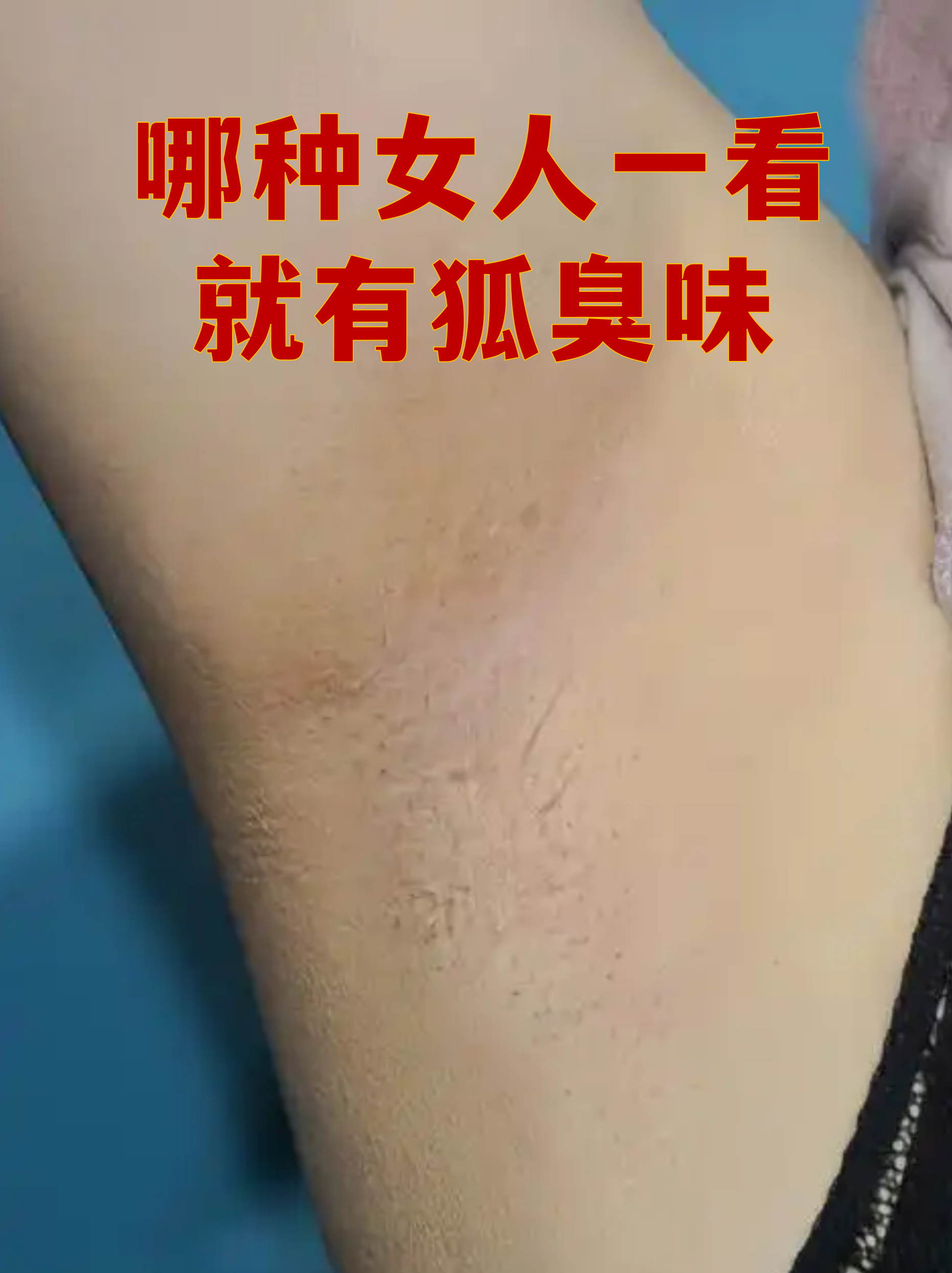 狐臭的人是谁的后代(狐臭的人和没有的人后代会不会慢慢淡了) 狐臭的人是谁的后代(狐臭的人和没有的人后代会不会慢慢淡了)